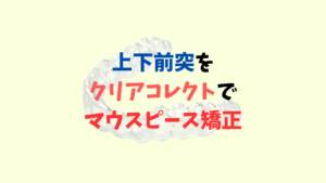 上下前突　口ゴボをインビザラインのジェネリック　クリアコレクトで矯正のサムネイル画像