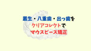 叢生で八重歯と出っ歯をインビザラインのジェネリック　クリアコレクトで矯正　お口の再生博士のサムネイル画像