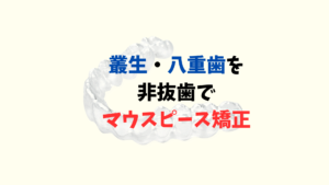 叢生の八重歯をインビザラインで非抜歯矯正　お口の再生博士のサムネイル画像