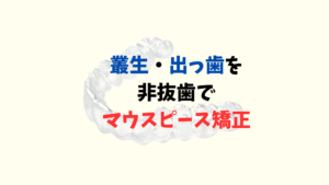 叢生➕出っ歯をインビザラインのジェネリック　クリアコレクトで非抜歯矯正　Ⅱ級ゴムを使用しました　お口の再生博士のサムネイル画像