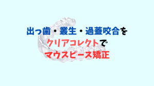 出っ歯　叢生　過蓋咬合をインビザラインのジェネリック　クリアコレクトで矯正　お口の再生博士のサムネイル画像