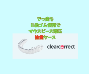 でっ歯をクリアコレクトで矯正は抜歯と非抜歯で計画を創って下さいその1　お口の再生博士のサムネイル画像