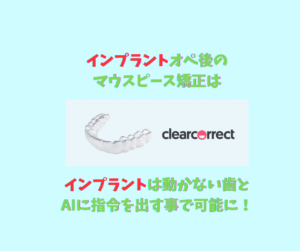 インプラント入れた後でもマウスピース矯正は可能　お口の再生博士のサムネイル画像