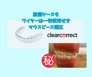 でっ歯と叢生を抜歯してマウスピース矯正のクリアコレクトで矯正　お口の再生博士のサムネイル画像