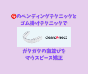 叢生を非抜歯でインビザラインのジェネリックで矯正　お口の再生博士のサムネイル画像