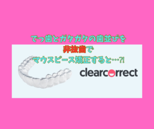 叢生と出っ歯を抜歯と非抜歯でマウスピース矯正のインビザラインのジェネリック　クリアコレクトで計画を立てました　その2 お口の再生博士のサムネイル画像