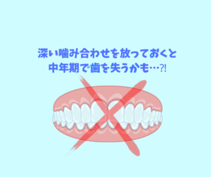 過蓋咬合をバイトランプとゴム掛けしてマウスピース矯正で矯正　その2  お口の再生博士のサムネイル画像