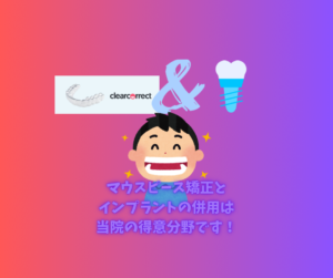 出っ歯と叢生をマウスピース矯正とインプラントで治療　お口の再生博士のサムネイル画像