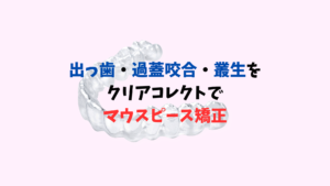 でっ歯　過蓋咬合　叢生をマウスピース矯正はゴム掛けとバイトランプが有効　お口の再生博士のサムネイル画像