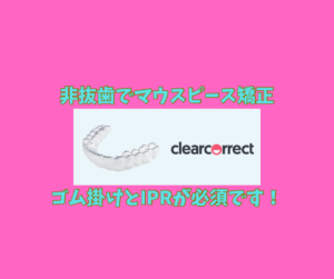 出っ歯と叢生をマウスピース矯正のインビザラインのジェネリック　クリアコレクトで矯正 お口の再生博士のサムネイル画像