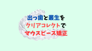 上顎前突　叢生をマウスピース矯正で治療はゴムかけが必要　お口の再生博士のサムネイル画像