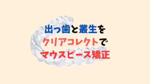 上顎前突と叢生をゴムかけしてマウスピース矯正で治療　お口の再生博士のサムネイル画像