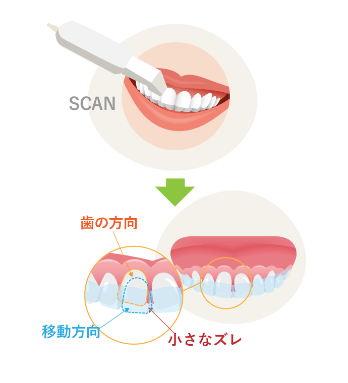 マウス ピース 口 が 閉まら ない