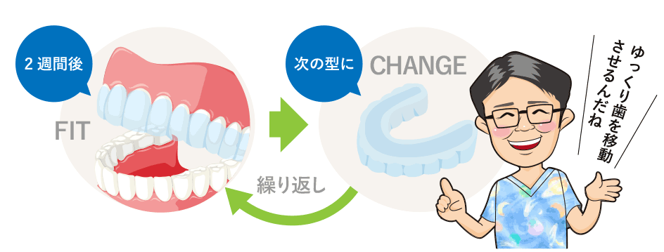 図解:2週間後の歯の動きと新しく作られたマウスピース矯正装置について説明する金田院長