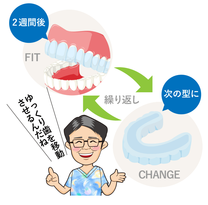 図解:2週間後の歯の動きと新しく作られたマウスピース矯正装置について説明する金田院長