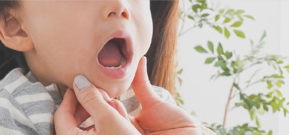 小児矯正